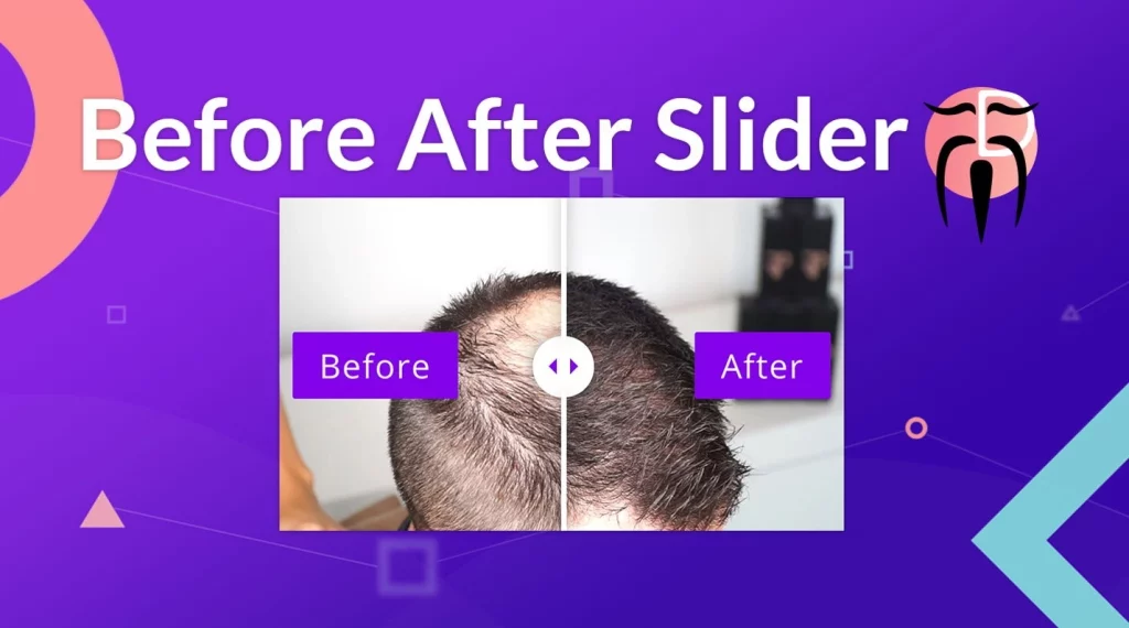 The Divi Sensei Before After Slider is THE module to compare images. A good looking and easily usable image comparison is a huge deal in many industries like artistry