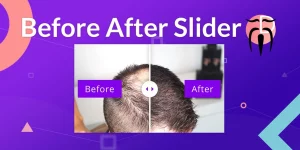 The Divi Sensei Before After Slider is THE module to compare images. A good looking and easily usable image comparison is a huge deal in many industries like artistry